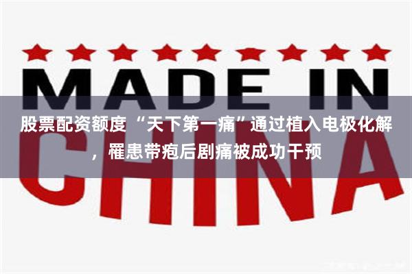 股票配资额度 “天下第一痛”通过植入电极化解，罹患带疱后剧痛被成功干预